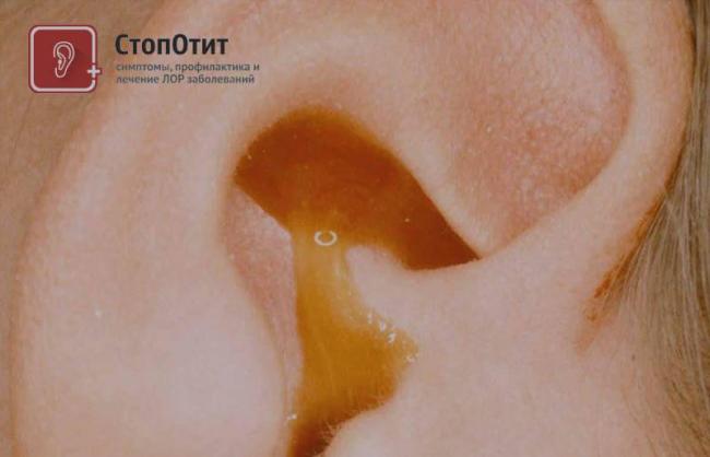 Борный спирт отзывы