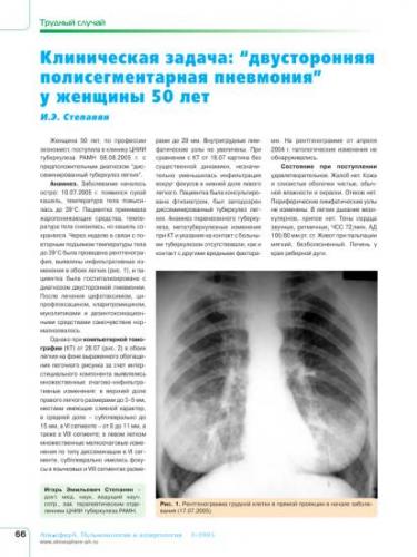Как отличить туберкулез легких от пневмонии по признакам и результатам обследования?