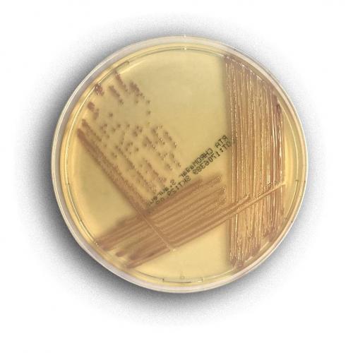 Опасно ли обнаружение кишечной палочки (escherichia coli) в моче?