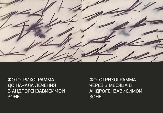 Методики лечения волос и кожи головы