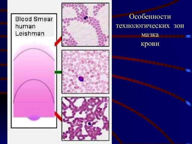 Антитела iga, igg, igm к хламидии пневмонии (pneumoniae)