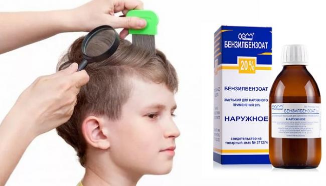 Бензилбензоат мазь и эмульсия от чесотки: инструкция, отзывы