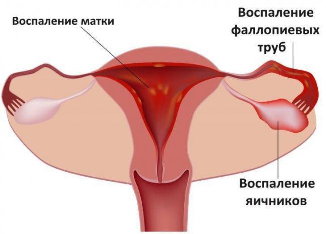 Лекарственный препарат Sopharma. Индометацин софарма 50 мг. - отзывы