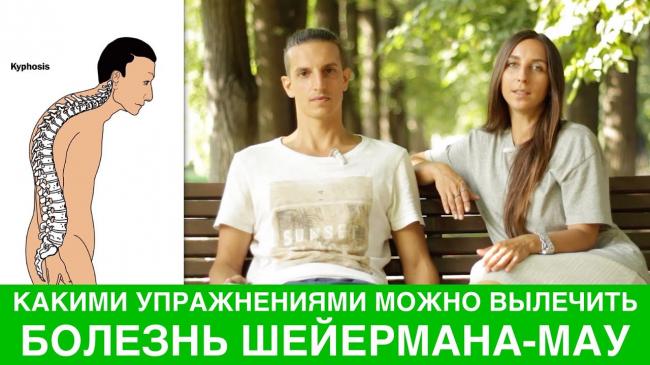 Симптомы болезни шейермана-мау и методы лечения синдрома