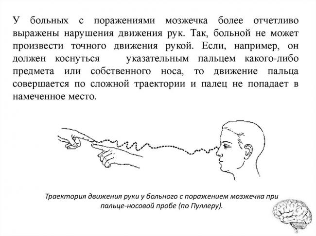 Адиадохокинез