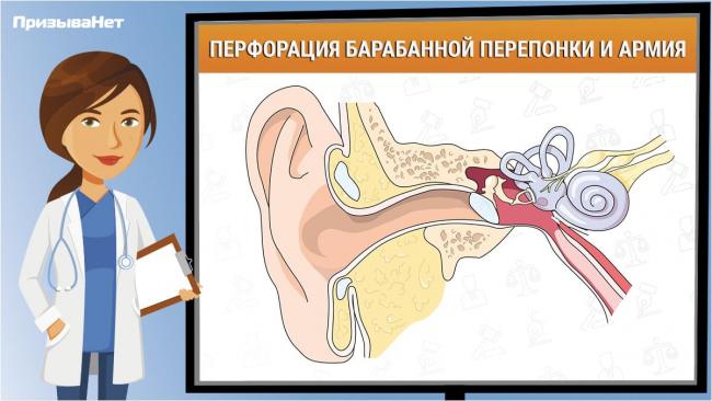 Могут ли лопнуть перепонки в самолете