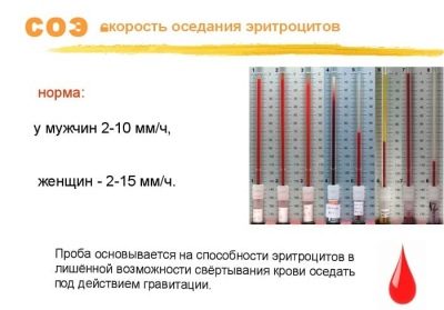 Что значит соэ 35 у женщины, и какие причины повышения соэ?