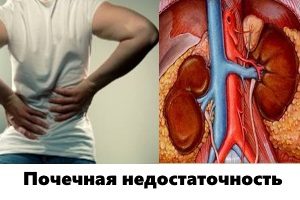 Алерон