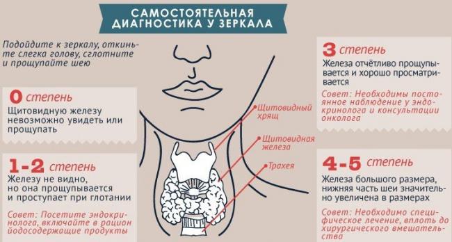 Зоб щитовидной железы. причины, симптомы, диагностика и лечение зоба