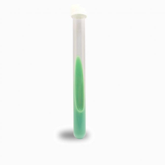 Escherichia coli в моче у грудничка или ребёнка, что это такое