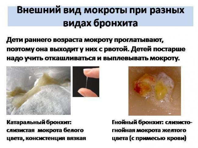 Мокрота при бронхиальной астме: цвет, характер