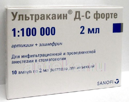 Ультракаин в стоматологии: показания, дозировка и эффективность