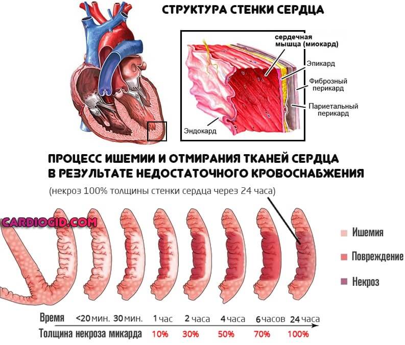 Ограничения по работе после акш. Реабилитация после шунтирования сердца