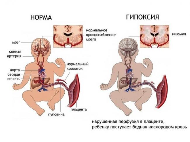 Скрининг первого триместра: расшифровка