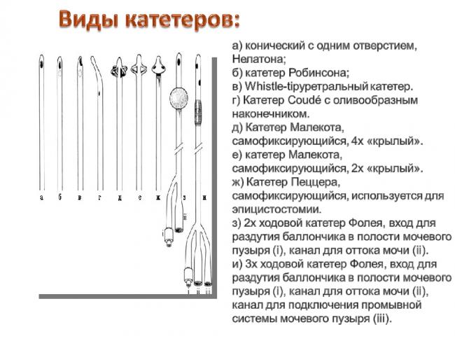 Как проводится катетеризация у женщин?