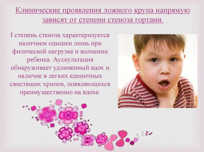 Острый ларингит (ложный круп) у детей