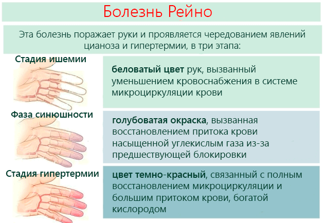 Болезнь рейно. причины, симптомы, диагностика и лечение патологии