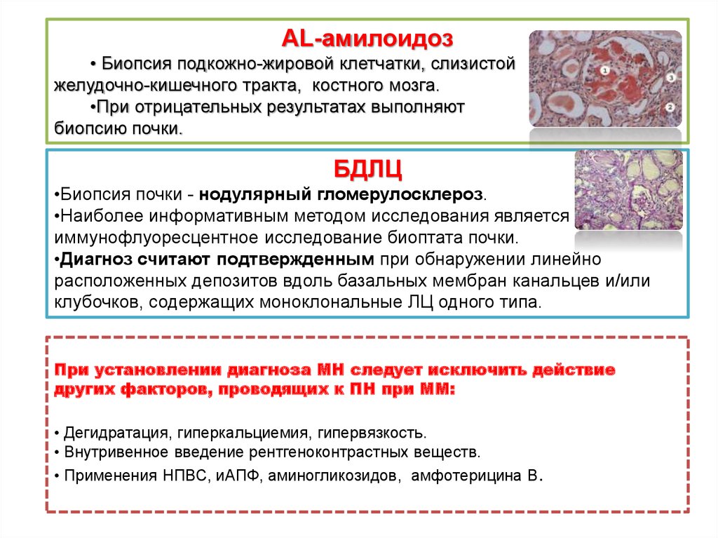 Диета при миеломе
