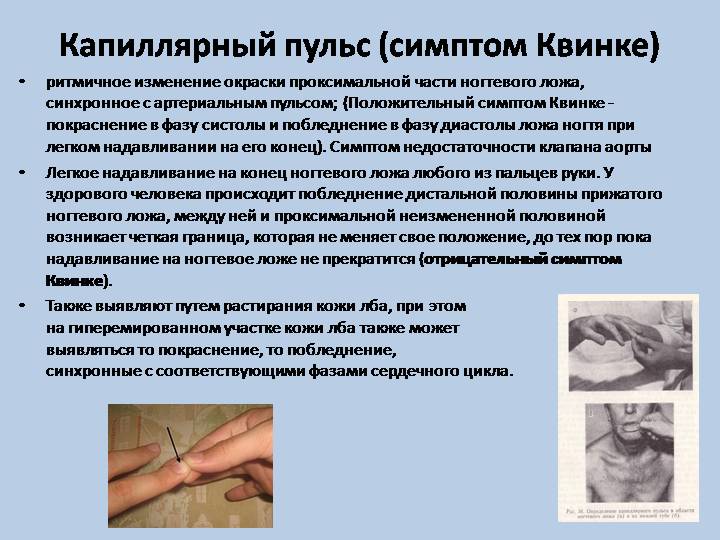 Как называется линия сердцебиения