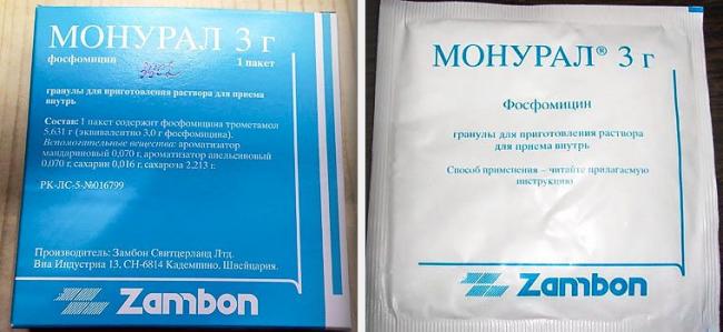 Цистит