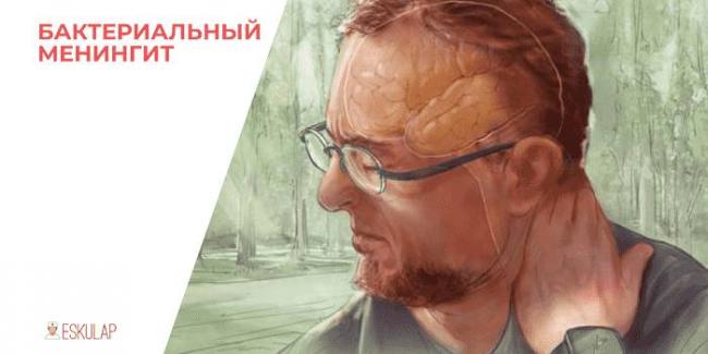 Менингит