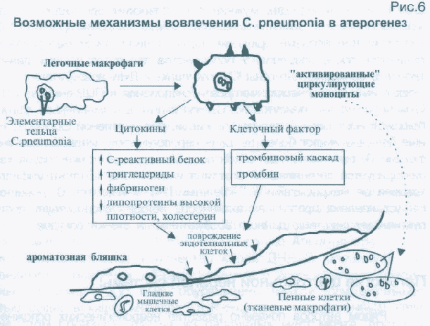 Chlamydia pneumoniae, iga, титр