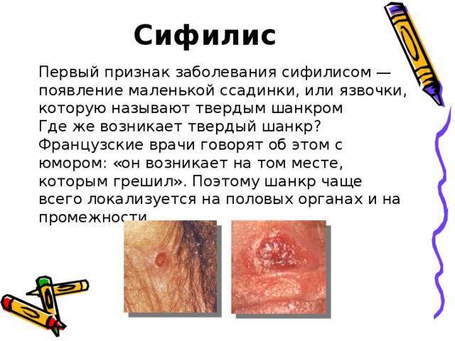 Иппп