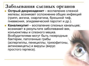 Дакриоаденит (воспаление слезных желез)