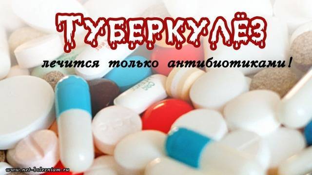 Признаки и способы лечения казеозной пневмонии при туберкулезе