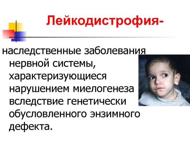 Лейкодистрофия головного мозга: причины, симптомы, лечение