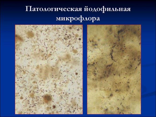 Чем меньше, тем лучше: особенности йодофильной флоры и чем она опасна