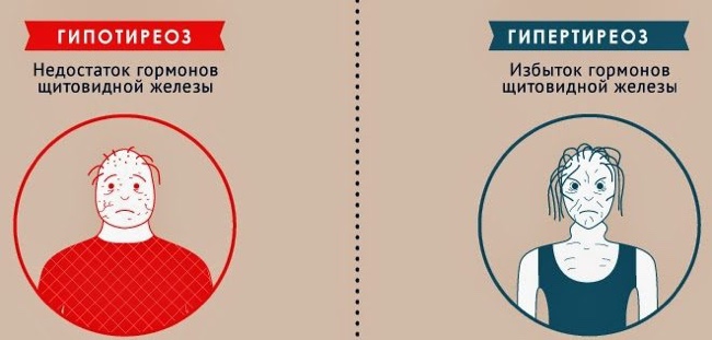 Эффективная диета при тиреотоксикозе щитовидной железы