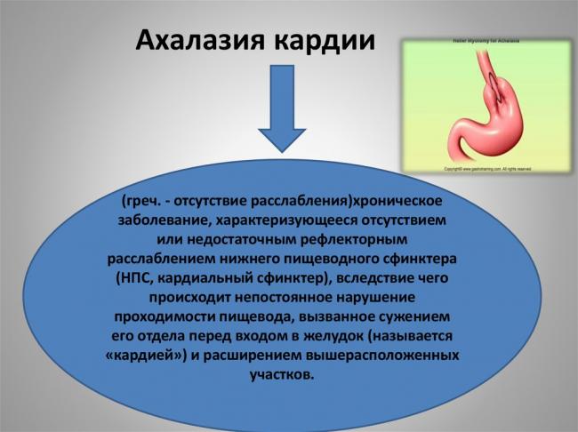 Ахалазия пищевода - симптомы болезни, профилактика и лечение ахалазии пищевода, причины заболевания и его диагностика на eurolab