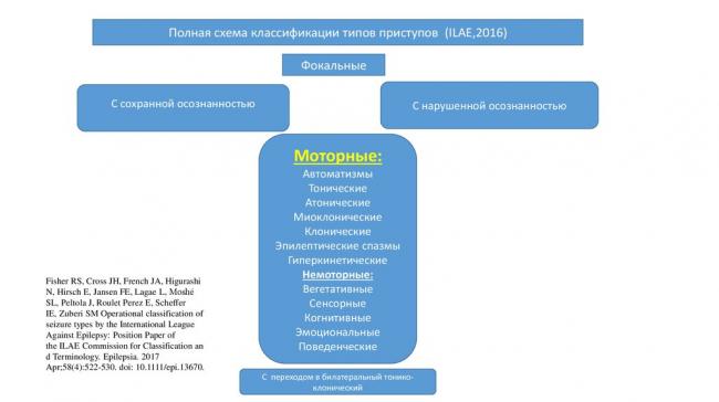 Абсанс