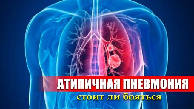 Осторожно, пневмония! как распознать на ранних стадиях и помочь себе в выздоровлении