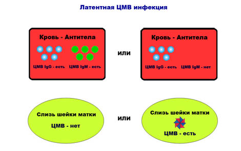Возможные последствия цмв-инфекции — чем опасен цитомегаловирус