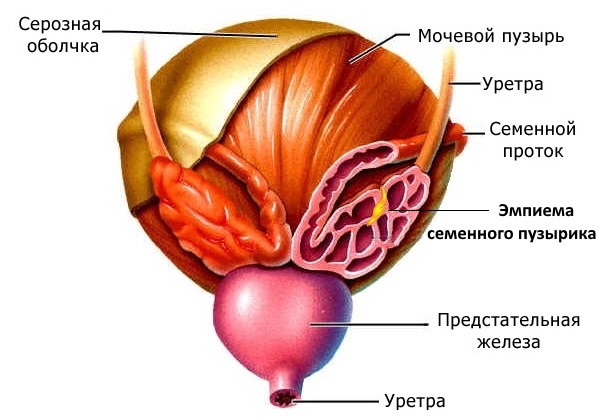 Хронический простатит: причины, симптомы, диагностика и лечение