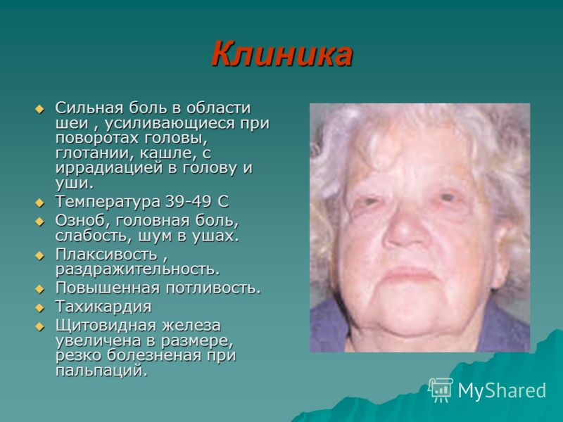 Тиреоидит щитовидной железы: симптомы, лечение, диета