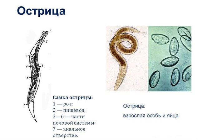Как избавиться от остриц в домашних условиях за короткий срок?