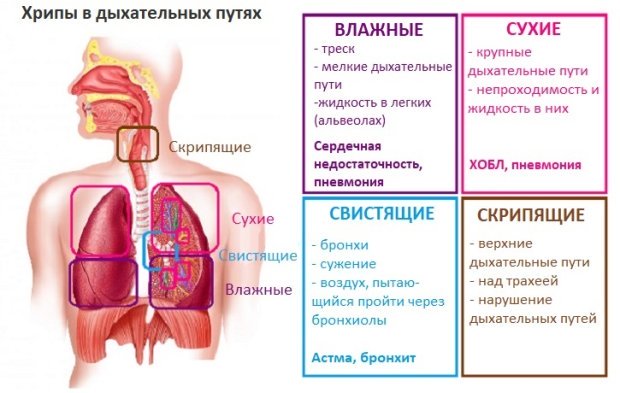 Чем отличается пневмония от воспаления легких
