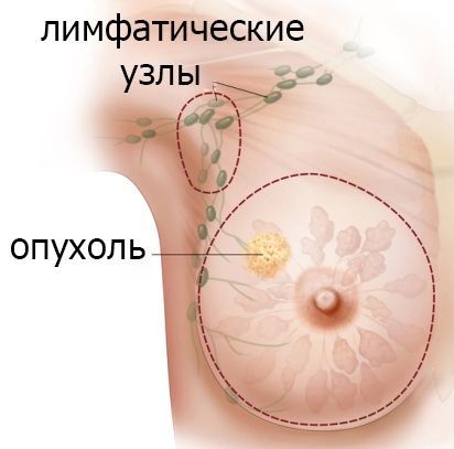 Диета для груди