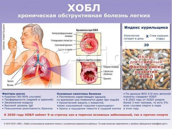 Хобл: классификация по степени тяжести, этиология, патогенез, диагностика, лечение, 2, 4, как долго можно прожить