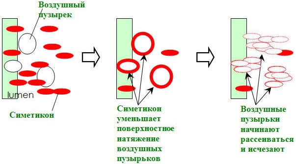 7 препаратов с симетиконом