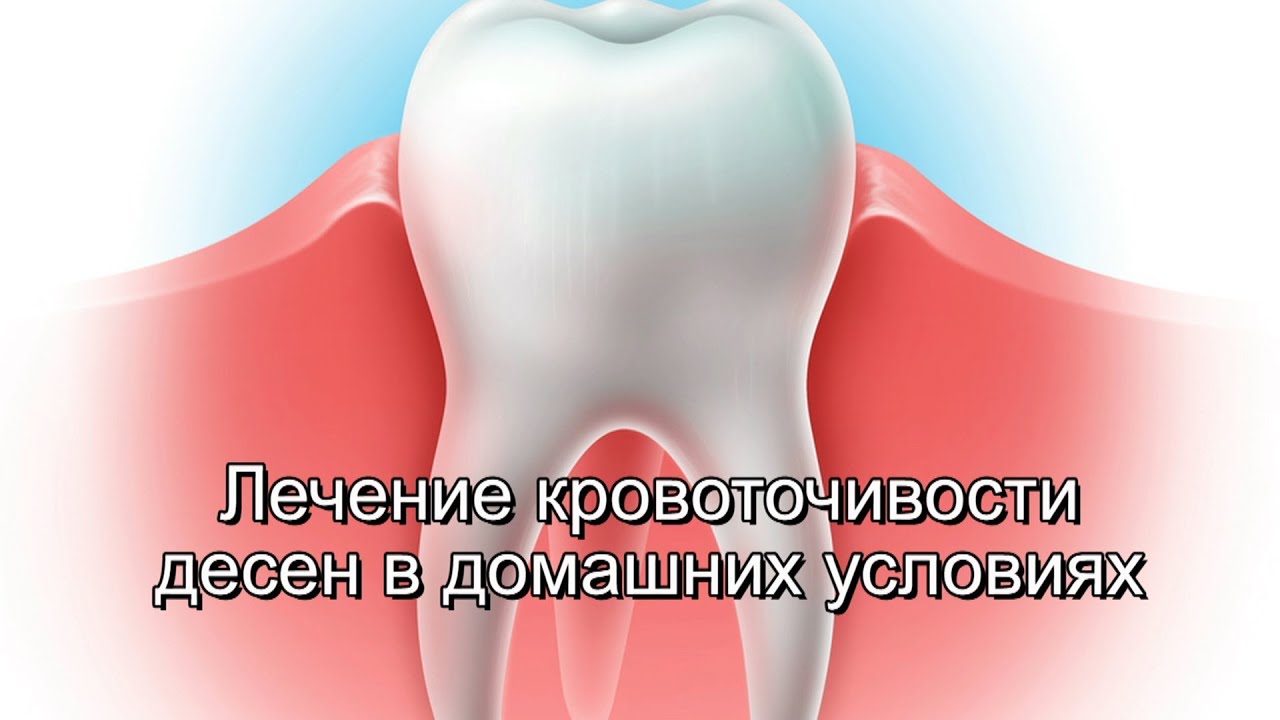 Кровоточивость десен – причины, лечение, профилактика