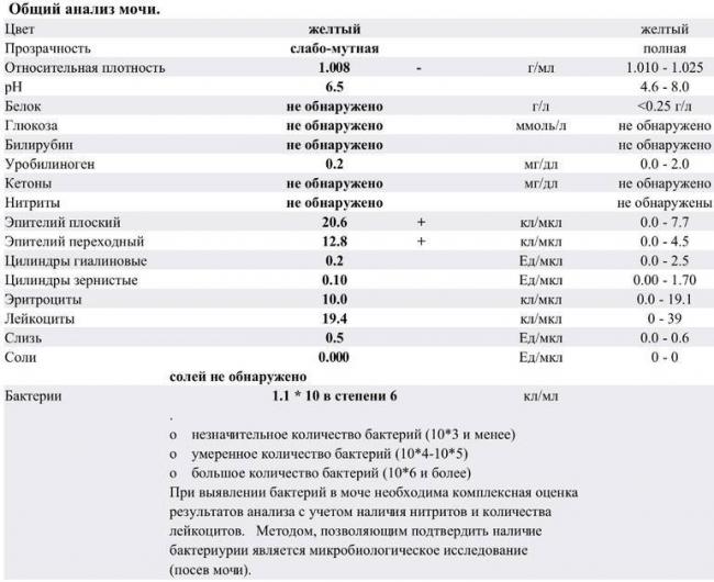 Причины появления бактерий в моче у ребенка