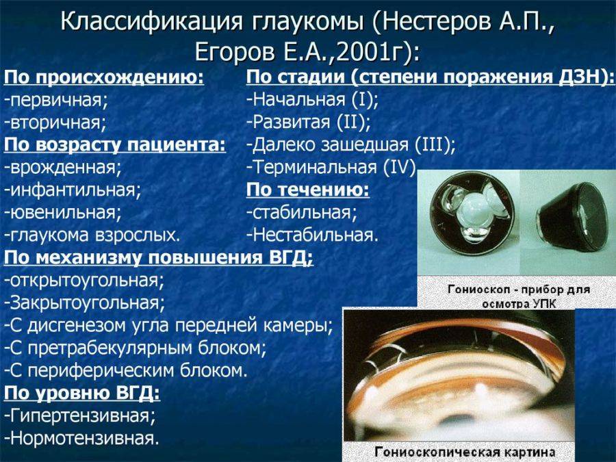 Глаукома: симптомы и лечение, что это такое - открытоугольная и закрытоугольная, признаки и острый приступ, профилактика, лечение