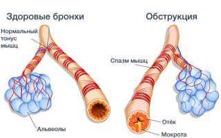 Какие анализы делают при кашле
