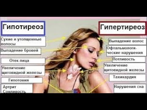 Тиреоидиты