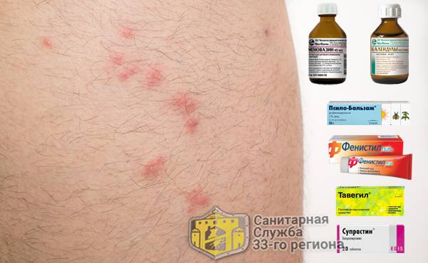 Лечение укусов постельных клопов: 10 лучших средств