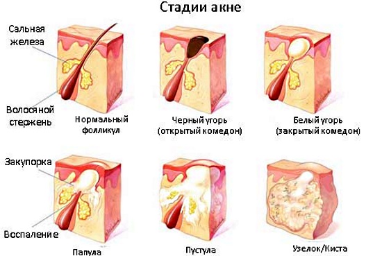 Синтомициновая мазь. инструкция по применению, цена, аналоги, отзывы